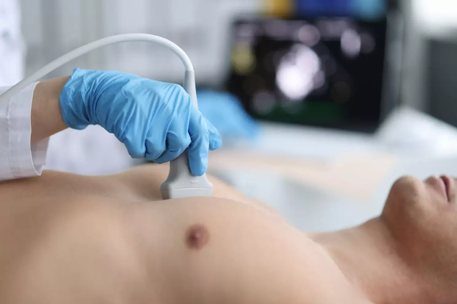 Echo aorta, hartecho onderzoek uitleg